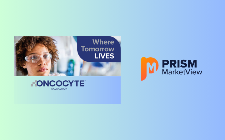 Breakthrough in Kidney Transplant Monitoring: PRISM MarketView Spotlights Oncocyte’s VitaGraft Study