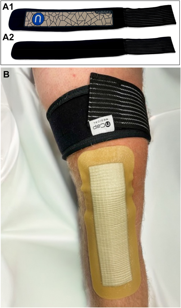 nCAP Medical NeuroCuple® Nanotechnology Device
